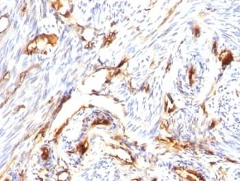 B2M / Beta 2 Microglobulin Antibody (clone B2M/1118)