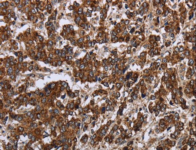 PPP1R13L / iASPP Antibody