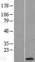 CT83 / CXorf61 Protein (Over-Expression Lysate Myc-DDK (Flag))