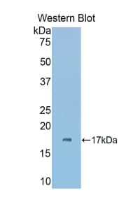 CA6 / Carbonic Anhydrase 6 Antibody (aa194-313)