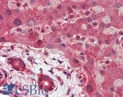 IHC-plus™ Monoclonal Mouse anti-Human ITCH / AIP4 Antibody (IHC, IF)