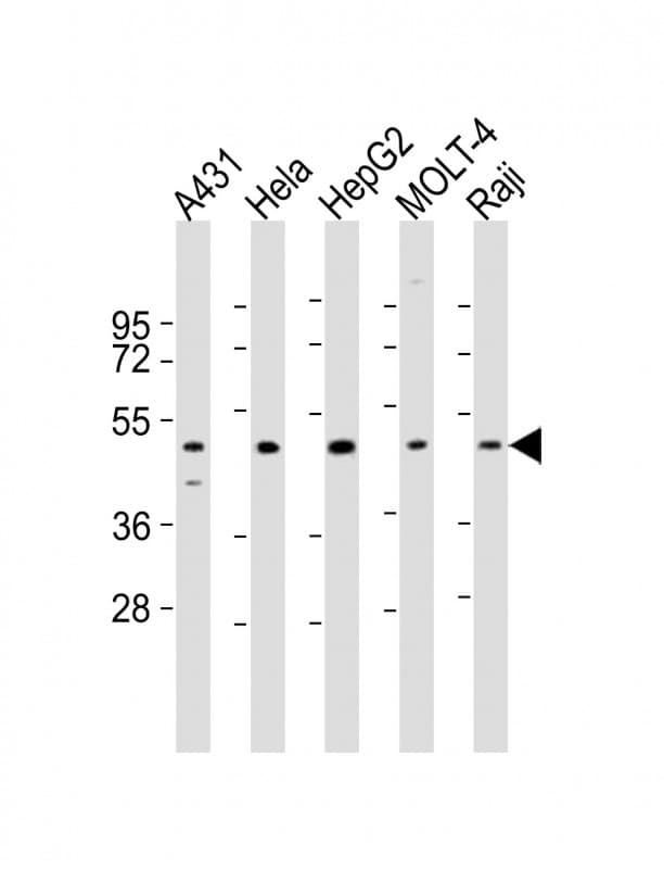 CYP24 / CYP24A1 Antibody (aa34-64)