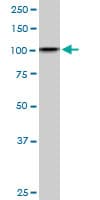 Monoclonal Mouse anti-Human DDX11 / CHLR1 Antibody (clone 3C1, IHC, WB)