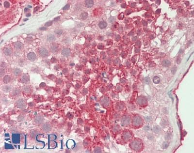 Polyclonal Rabbit anti-Mouse WDFY1 Antibody (aa42-91, IHC, WB)