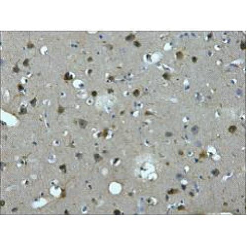 Monoclonal Mouse anti-Human MAP2 Antibody (clone 7D4, IHC)
