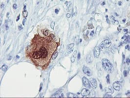 SDS Antibody (clone OTI2F6, Carrier-free)