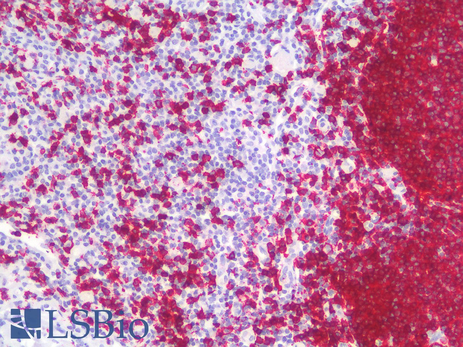 PathPlus™ CD20 Antibody (clone rIGEL/773)