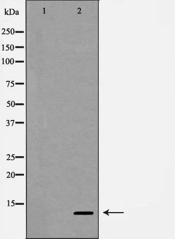 Polyclonal Rabbit anti-Human SDF1 / CXCL12 Antibody (IHC, WB)
