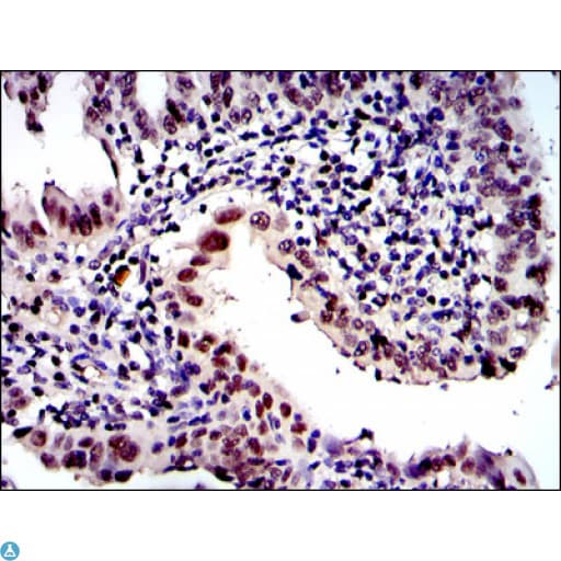 PSMB8 / LMP7 Antibody
