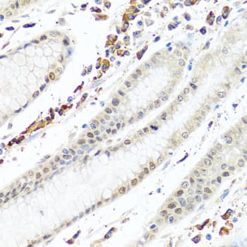Polyclonal Rabbit anti-Human PTEN Antibody (IHC, WB)