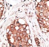 HPCAL1 / Hippocalcin-Like 1 Antibody (aa2-32)