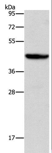 IHC-plus™ Polyclonal Rabbit anti-Human ORM2 / Orosomucoid 2 Antibody (IHC, WB)