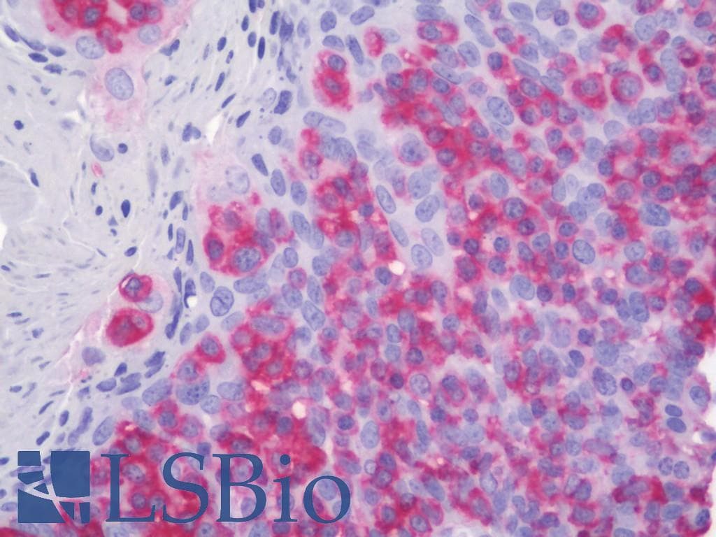 IHC-plus™ ACTBL2 Antibody