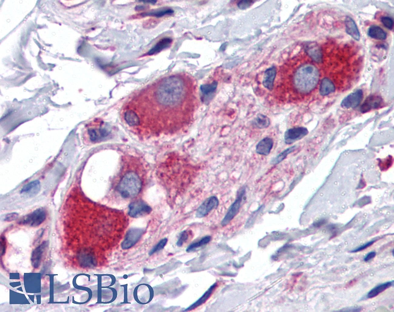 IHC-plus™ Polyclonal Goat anti-Human ARL6IP5 Antibody (aa177-188, IHC, WB)