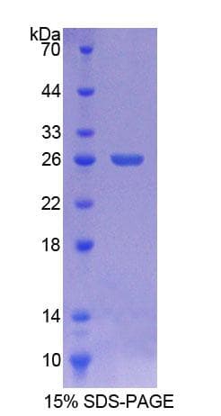 Human LIM2 Protein (Recombinant His-T7)