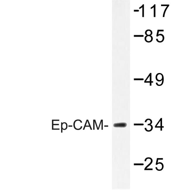 EPCAM Antibody (His150)