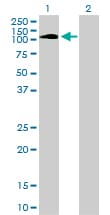 PTK2B / PYK2 Antibody (clone 1F9)