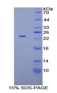 Human NME3 Protein (Recombinant His-T7)