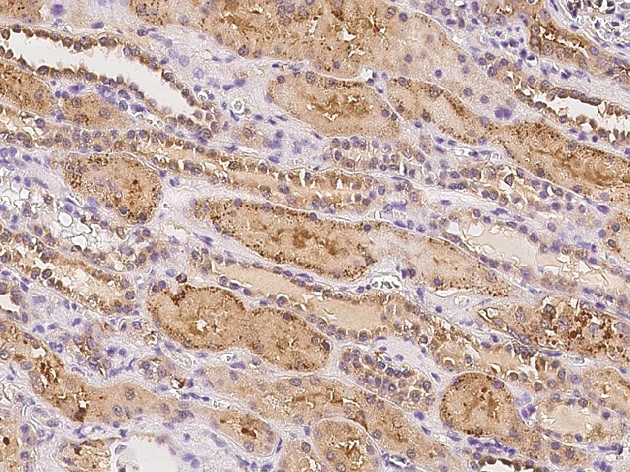 C19orf18 Antibody