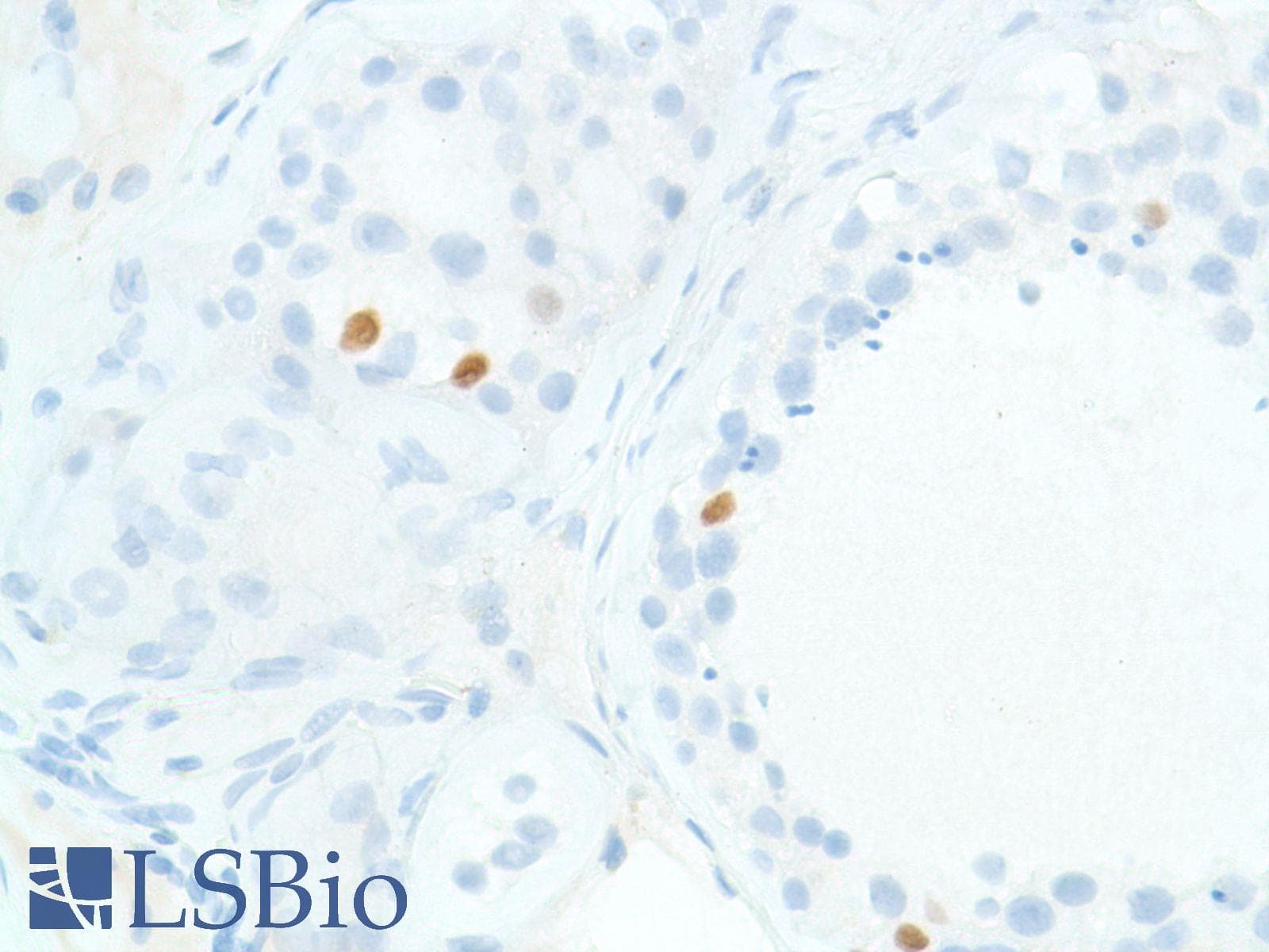 SOX2 Antibody (N-Terminus, clone SP76)