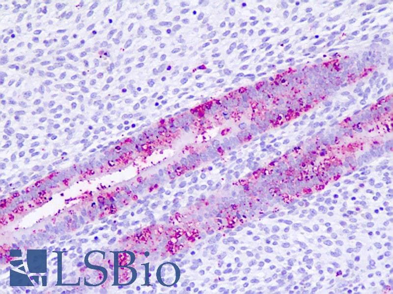 IHC-plus™ Polyclonal Rabbit anti-Human GPBAR1 / TGR5 Antibody (Cytoplasmic Domain, IHC)