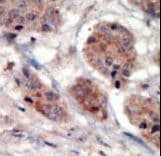 Polyclonal Rabbit anti-Human PI4K2A / PI4KII Antibody (aa1-30, IHC, IF, WB)