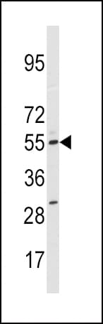P450SCC / CYP11A1 Antibody (aa88-120)