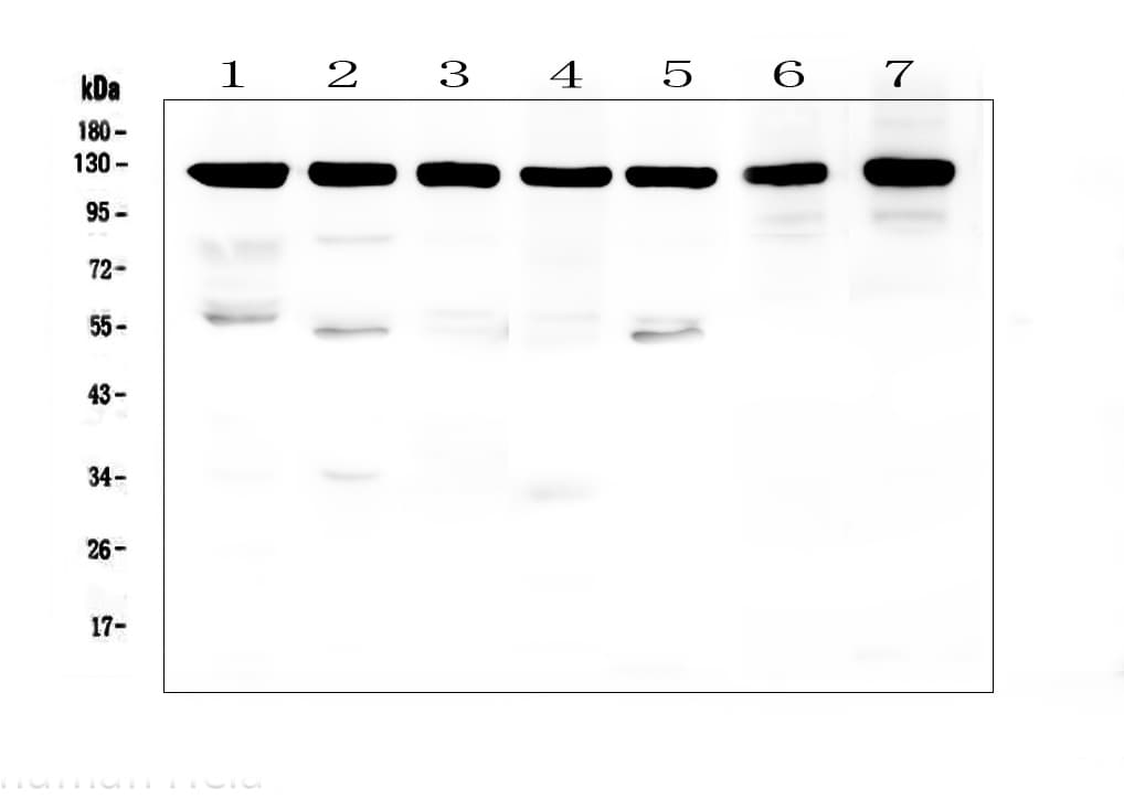 APP / Beta Amyloid Precursor Antibody (aa672-713)