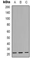 Polyclonal Rabbit anti-Human CBFB Antibody (N-Terminus, IHC, IF, WB)