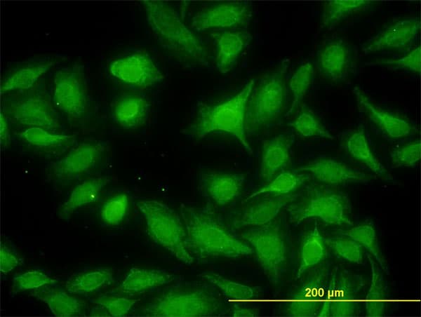 MKNK1 / MNK1 Antibody (clone 3E1)