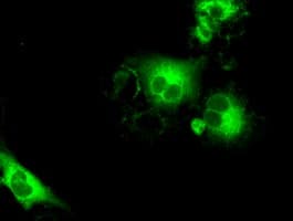 IHC-plus™ Monoclonal Mouse anti-Human SLC7A8 / LAT2 Antibody (clone 4H10, IHC, IF)
