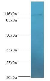MYO19 / Myosin XIX Antibody (aa2-770)