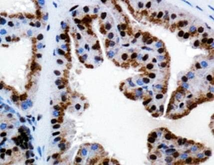 TRPM8 Antibody (aa250-300)