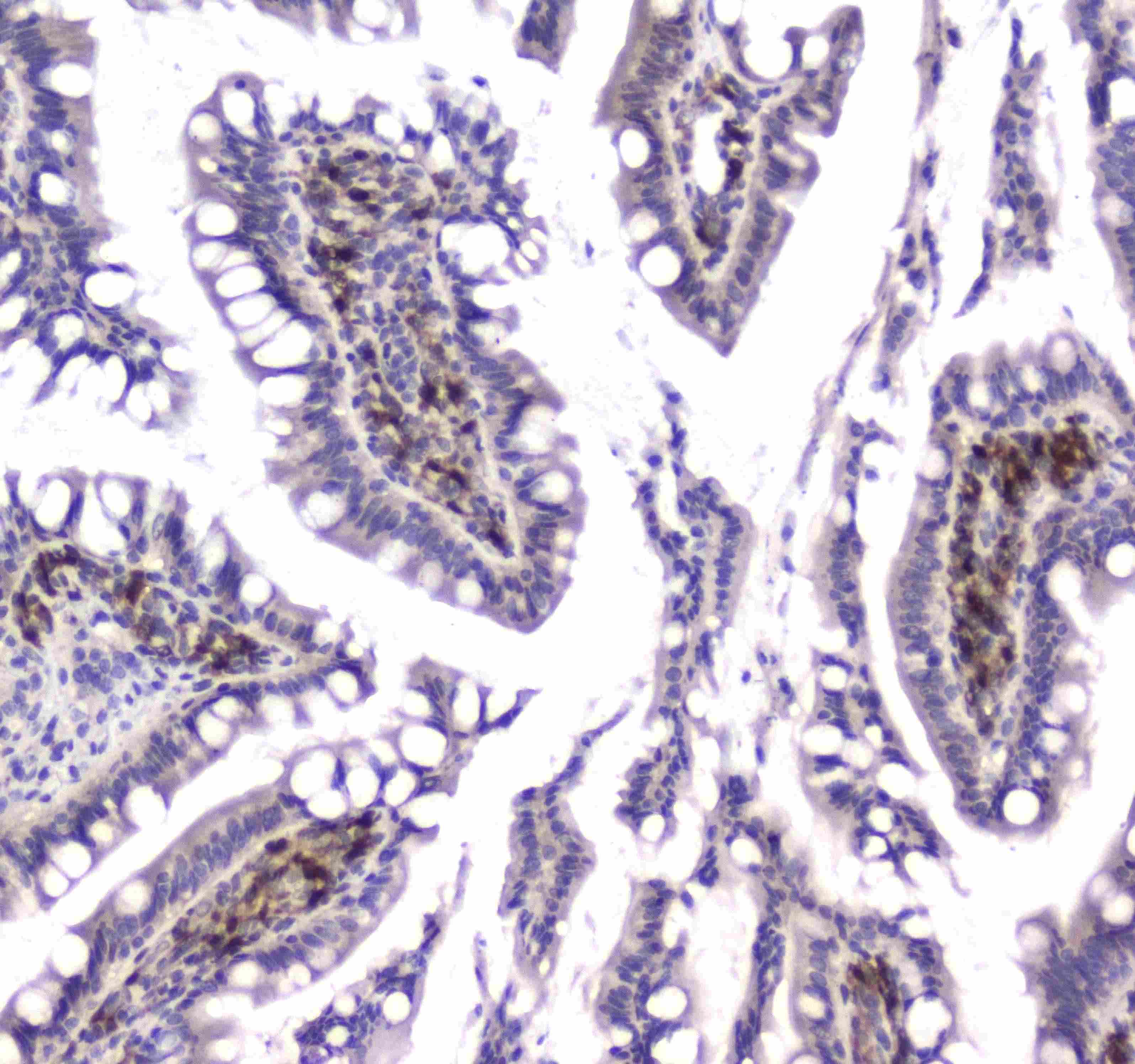 Polyclonal Rabbit anti-Human GLO1 / Glyoxalase I Antibody (IHC, WB)