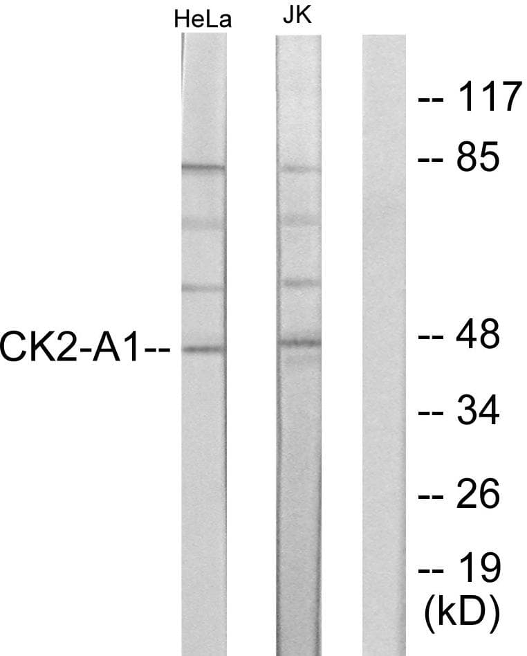 CSNK2A1 Antibody (p255)
