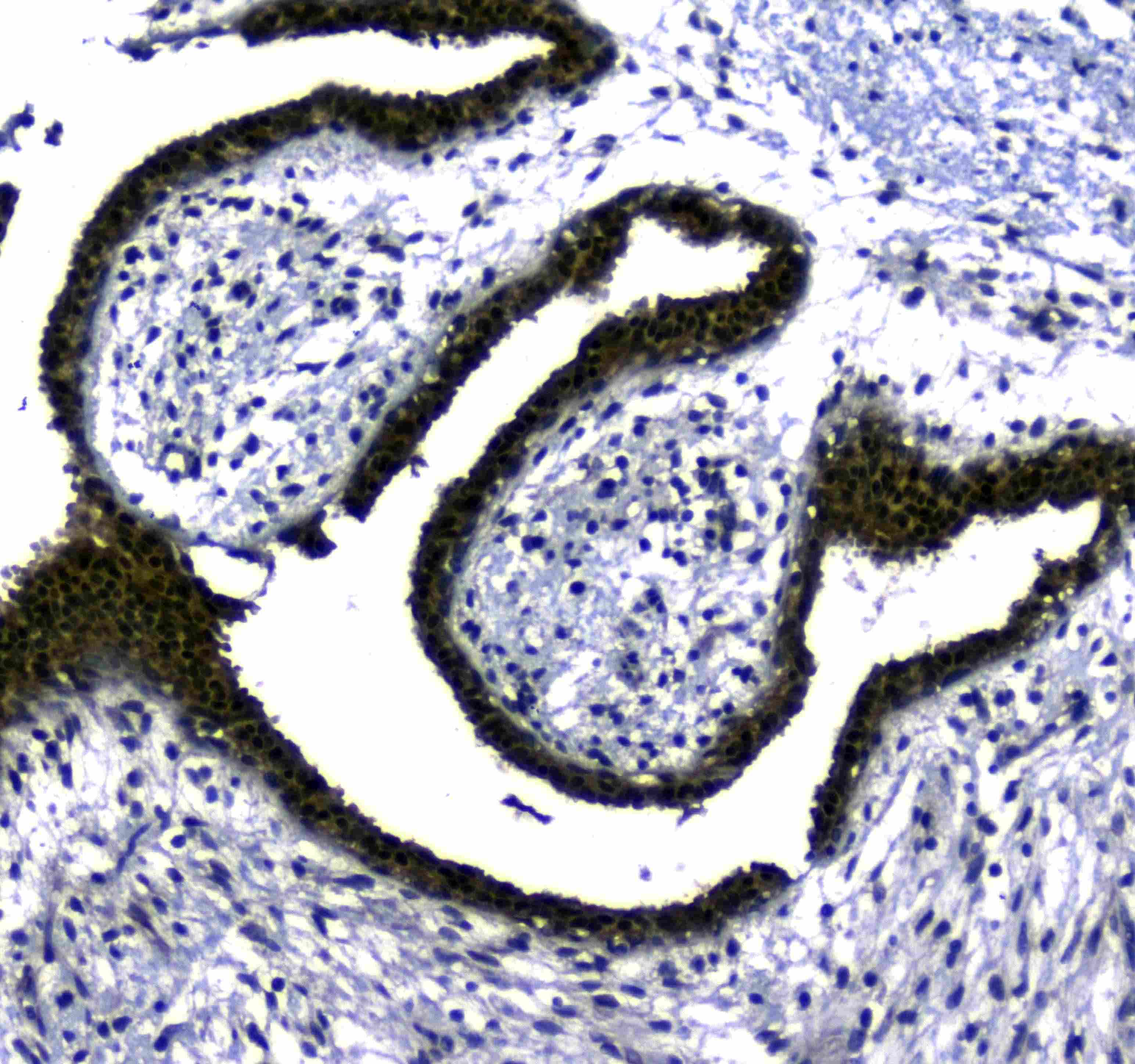 Polyclonal Rabbit anti-Human STUB1 / CHIP Antibody (IHC, WB)