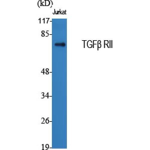 TGFBR2 Antibody (60-140 aa, Internal)
