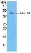 Rat NOG / Noggin Protein (Recombinant His-GST, N-terminus)