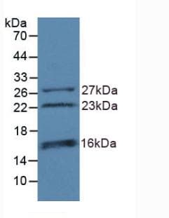 CHD3 Antibody (aa1551-1742, Cy3)
