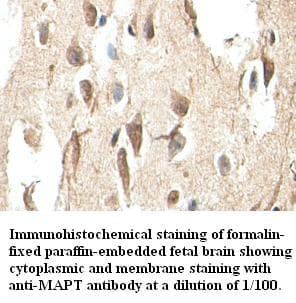 Polyclonal Rabbit anti-Human MAPT / Tau Antibody (IHC, WB)