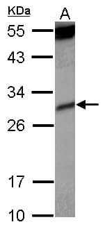 KIR2DS4 Antibody