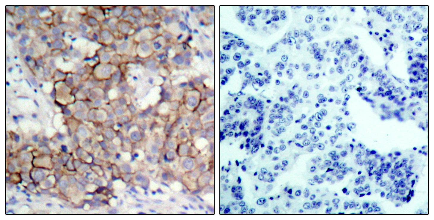 ERBB2 / HER2 Antibody (phospho-Tyr877)