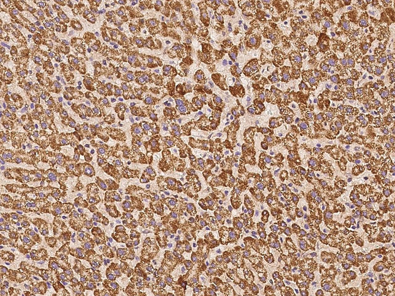 Polyclonal Rabbit anti-Human PECR Antibody (IHC, IF, WB)