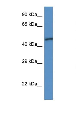 Polyclonal Rabbit anti-Human UQCRC1 Antibody (aa143-192, WB)