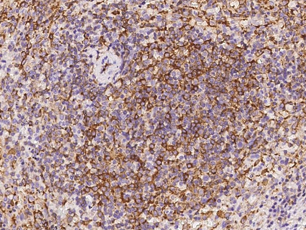 ABI3 Antibody