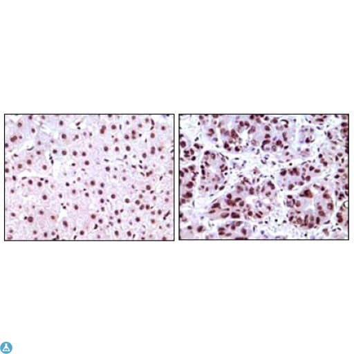 NPM1 / NPM / Nucleophosmin Antibody