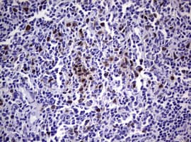 Monoclonal Mouse anti-Human TS / Thymidylate Synthase Antibody (clone OTI1B2, IHC, WB)
