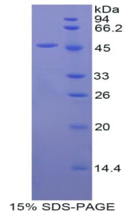 Mouse FGF10 Protein (Recombinant His-GST)