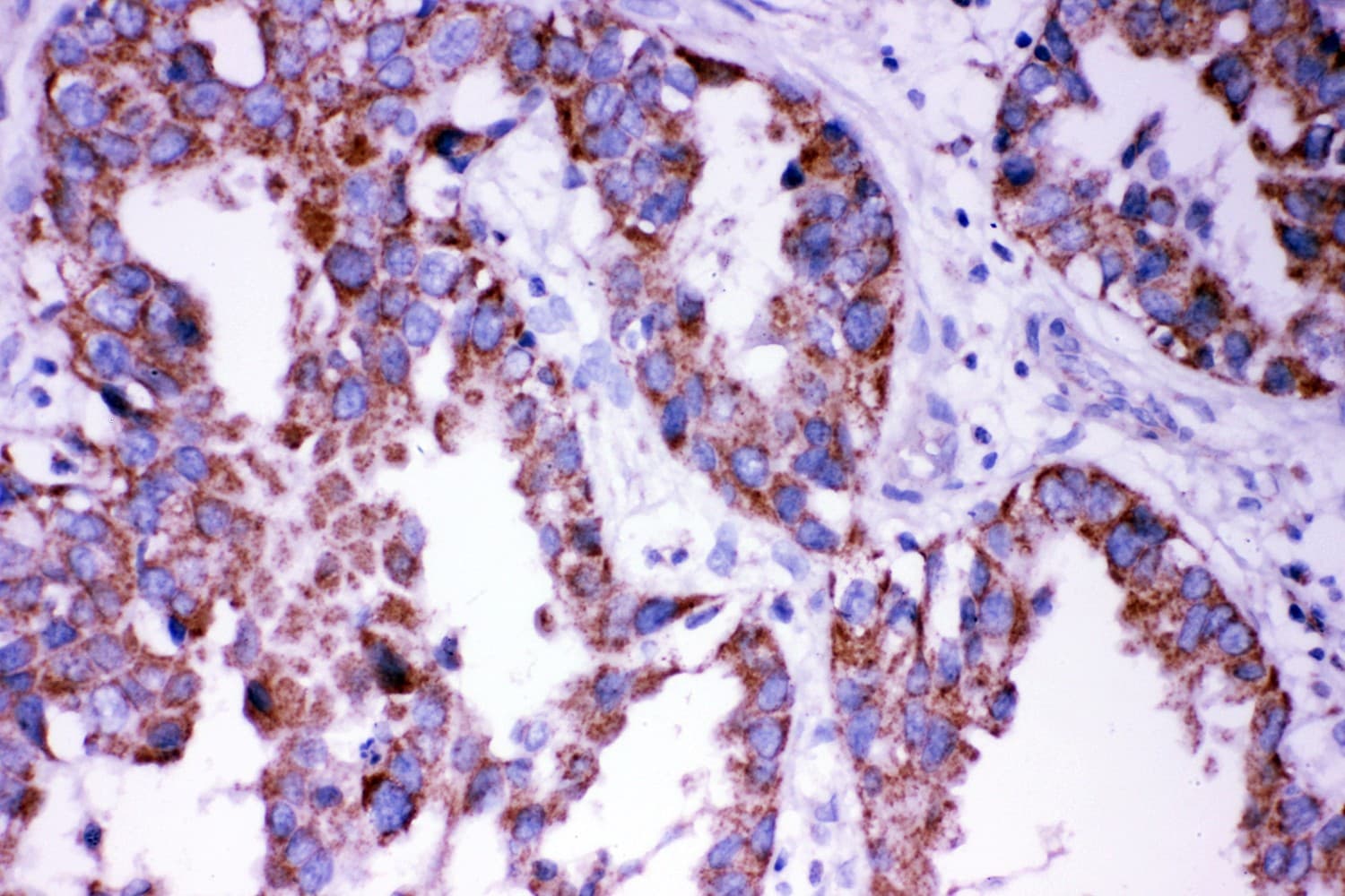Polyclonal Rabbit anti-Human DISC1 Antibody (aa461-477, IHC, WB)