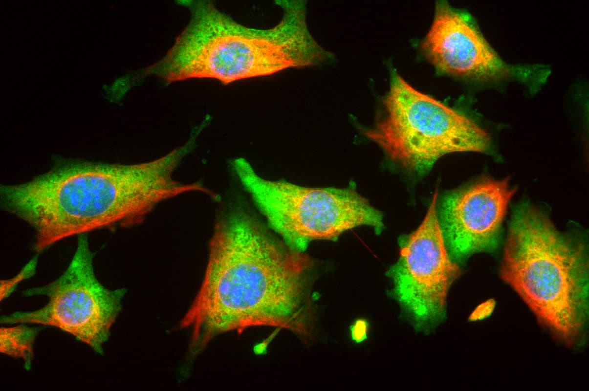ENO1 / Alpha Enolase Antibody (clone 253)